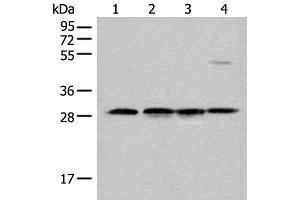 Western blot analysis of Human urinary bladder tissue Mouse heart tissue Mouse kidney tissue and RAW264. (CA7 Antikörper)