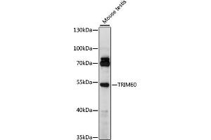 Western blot analysis of extracts of mouse testis, using TRIM60 antibody (ABIN7270995) at 1000 dilution.