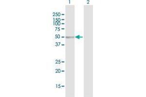Western Blotting (WB) image for anti-serpin Peptidase Inhibitor, Clade A (Alpha-1 Antiproteinase, Antitrypsin), Member 6 (SERPINA6) (AA 1-405) antibody (ABIN2566047)