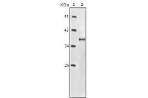 Western Blot showing IGF1R antibody used against truncated IGF1R recombinant protein.