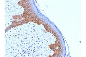 Formalin-fixed, paraffin-embedded human Skin stained with Desmoglein-3 Monoclonal Antibody (5G11). (Desmoglein 3 Antikörper)