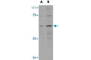 Western blot analysis of NOTUM in human kidney tissue lysate with NOTUM polyclonal antibody  at (A) 0. (NOTUM Antikörper  (N-Term))