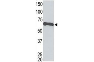 Tagged recombinant protein tested with the c-Myc antibody. (Myc Tag Antikörper  (AA 408-439))