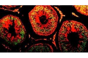 IF analysis of DR1 using anti-DR1 antibody (ABIN7602313).