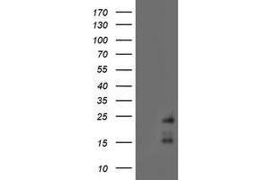 HEK293T cells were transfected with the pCMV6-ENTRY control (Left lane) or pCMV6-ENTRY RAMP2 (Right lane) cDNA for 48 hrs and lysed. (RAMP2 Antikörper)