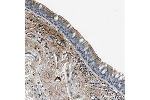 Immunohistochemical staining of human bronchus with TMEM186 polyclonal antibody  shows moderate cytoplasmic and membranous positivity in respiratory epithelial cells at 1:50-1:200 dilution.