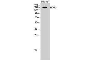 Western Blotting (WB) image for anti-Nitric Oxide Synthase 2, Inducible (NOS2) (Thr177) antibody (ABIN3176385) (NOS2 Antikörper  (Thr177))