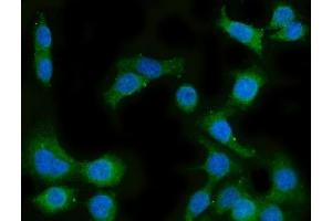 IF analysis of CYP51A1/CYP51 using anti-CYP51A1/CYP51 antibody (ABIN7600046).