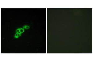 Immunofluorescence analysis of MCF-7 cells, using FSHR antibody. (FSHR Antikörper  (Internal Region))