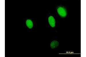 Immunofluorescence of purified MaxPab antibody to NPLOC4 on HeLa cell.
