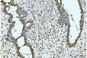 IHC analysis of EXOSC8 using anti-EXOSC8 antibody (ABIN7601850). (EXOSC8 Antikörper  (AA 49-216))