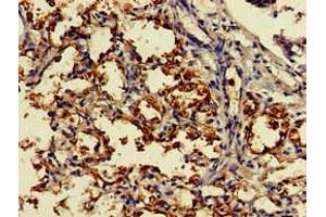 Immunohistochemistry of paraffin-embedded human lung tissue using ABIN7149454 at dilution of 1:100 (DDO Antikörper  (AA 37-161))