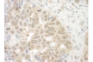anti-Eyes Absent Homolog 4 (EYA4) (AA 100-150) antibody