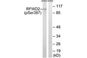 Western blot analysis of extracts from K562 cells treated with UV 15', using RFWD2 (Phospho-Ser387) Antibody. (RFWD2 Antikörper  (pSer387))