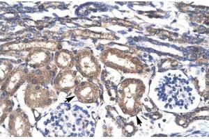 Immunohistochemical staining (Formalin-fixed paraffin-embedded sections) of human kidney with KLF8 polyclonal antibody .