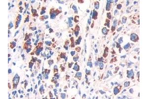 Immunohistochemistry (IHC) image for anti-Heat Shock 60kDa Protein 1 (Chaperonin) (HSPD1) (AA 172-343) antibody (ABIN7438895)