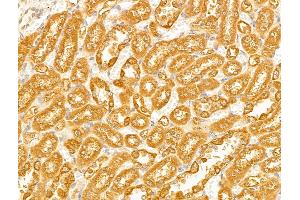 ABIN6265959 and ABIN6268944 at 1/100 staining Rat lung tissue by IHC-P.