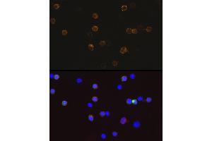 Immunofluorescence analysis of 293T-BC-Flag-GFP-C cells using Mouse anti DDDDK-Tag mAb (ABIN3020558, ABIN3020559, ABIN3020560 and ABIN1512923) at dilution of 1:100 (40x lens). (DYKDDDDK Tag Antikörper)