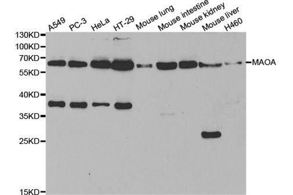 Monoamine Oxidase A Antikörper  (AA 1-260)