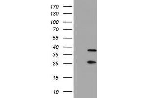 Western Blotting (WB) image for anti-Proteasome (Prosome, Macropain) Subunit, beta Type, 7 (PSMB7) (AA 58-277) antibody (ABIN1491598) (PSMB7 Antikörper  (AA 58-277))