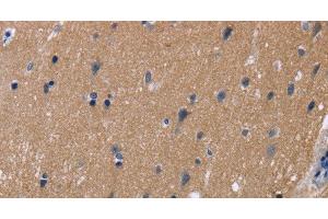 Immunohistochemistry of paraffin-embedded Human brain tissue using KCNJ11 Polyclonal Antibody at dilution 1:40 (KCNJ11 Antikörper)