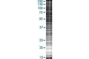 ST3GAL3 transfected lysate. (ST3GAL3 293T Cell Transient Overexpression Lysate(Denatured))