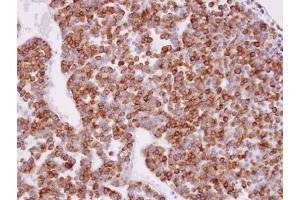 IHC-P Image Immunohistochemical analysis of paraffin-embedded human pituitary gland tumor, using XPR1, antibody at 1:100 dilution. (xpr1 Antikörper  (N-Term))