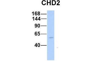Host:  Rabbit  Target Name:  CHD2  Sample Type:  Human Fetal Muscle  Antibody Dilution:  1. (CHD2 Antikörper  (N-Term))