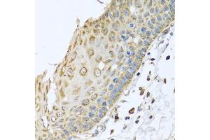 Immunohistochemistry of paraffin-embedded human esophagus using ARFGAP3 antibody (ABIN5974520) at dilution of 1/100 (40x lens). (ARFGAP3 Antikörper)