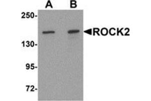 Western blot analysis of ROCK2 in mouse brain tissue lysate with ROCK2 antibody at (A) 1 and (B) 2 μg/ml (ROCK2 Antikörper  (Center))