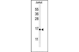 Western blot analysis in Jurkat cell line lysates (35 ug/lane) using RPS25 Antibody (N-term) Cat. (RPS25 Antikörper  (N-Term))