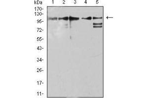 Western blot analysis using ZFP91 mouse mAb against Jurkat (1), A431 (2), HepG2 (3), HEK293 (4), and A549 (5) cell lysate. (ZFP91 Antikörper  (AA 162-304))