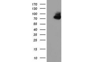 Western Blotting (WB) image for anti-Oxysterol Binding Protein-Like 11 (OSBPL11) antibody (ABIN1499919) (OSBPL11 Antikörper)