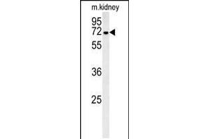 Western blot analysis in mouse kidney tissue lysates (35ug/lane). (GNE Antikörper  (C-Term))
