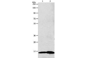 Western Blot analysis of 293T cell and Human fetal brain tissue using LHB Polyclonal Antibody at dilution of 1:800 (LHB Antikörper)