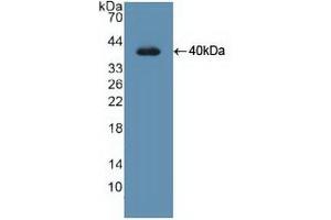 Figure. (UNG Antikörper  (AA 1-313))
