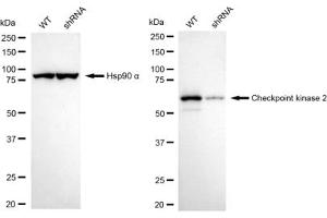 Western blotting analysis using Checkpoint kinase 2 antibody (ABIN7798039).