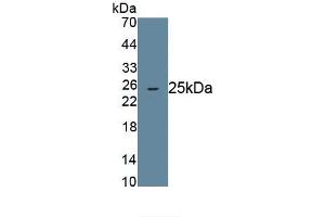 Detection of Recombinant ANGPTL8, Human using Monoclonal Antibody to Angiopoietin Like Protein 8 (ANGPTL8) (C19ORF80 Antikörper  (AA 24-196))