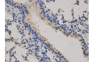 Immunohistochemistry (IHC) image for anti-Carcinoembryonic Antigen-Related Cell Adhesion Molecule 3 (CEACAM3) antibody (ABIN1871781)