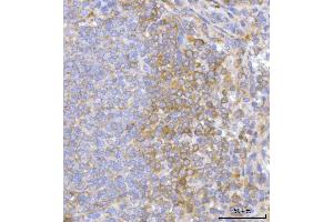 IHC analysis of Hamartin/TSC1 using anti-Hamartin/TSC1 antibody (ABIN7599499). (TSC1 Antikörper  (AA 1-618))