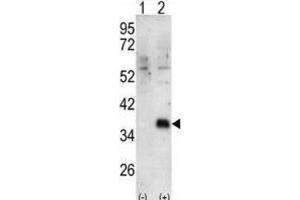 Western Blotting (WB) image for anti-Docking Protein 4 (DOK4) antibody (ABIN3003434) (DOK4 Antikörper)