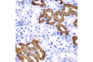 Immunohistochemistry of paraffin-embedded rat kidney using KRT19 antibody. (Cytokeratin 19 Antikörper)
