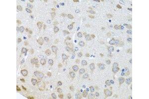 Immunohistochemistry of paraffin-embedded Mouse brain using Polyclonal AntibodyPC4 Polyclonal Antibody at dilution of 1:100 (40x lens). (SUB1 Antikörper)