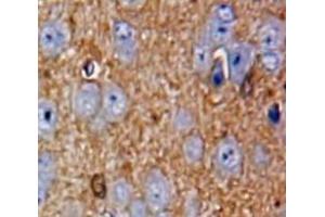 IHC-P analysis of Brain tissue, with DAB staining. (CILP Antikörper  (AA 604-864))
