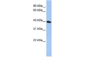 WB Suggested Anti-TSPAN17 Antibody Titration:  0. (Tetraspanin 17 Antikörper  (N-Term))