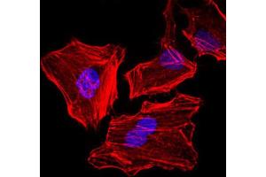 Immunofluorescence analysis of HeLa cells. (Cytokeratin 5 Antikörper)