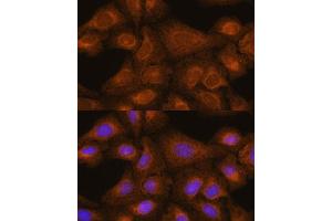 Immunofluorescence analysis of U-2 OS cells using [KO] GIT1 antibody (ABIN7267383) at dilution of 1:100. (GIT1 Antikörper  (AA 460-640))