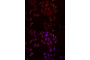 Immunofluorescence analysis of A549 cells using FRZB antibody (ABIN5973961). (FRZB Antikörper)