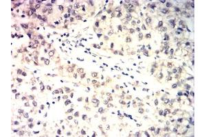 Immunohistochemistry (IHC) image for anti-TAR DNA Binding Protein (TARDBP) antibody (ABIN7193979)