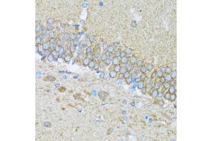 Immunohistochemistry of paraffin-embedded mouse brain using CASP3 antibody. (Caspase 3 Antikörper)